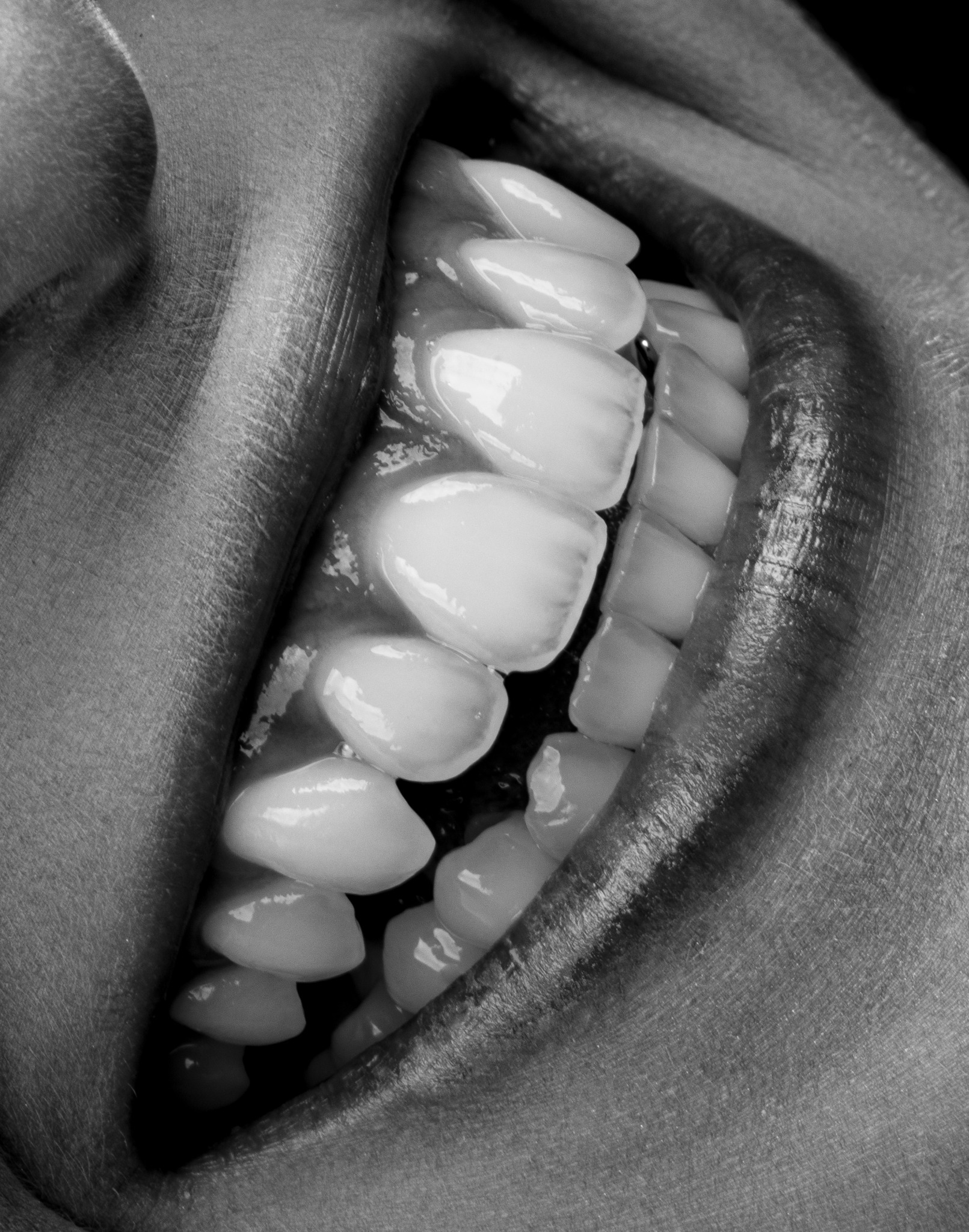 Fotografia odontológica em preto e branco mostrando detalhes do sorriso